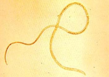 Capillaria philippinensis